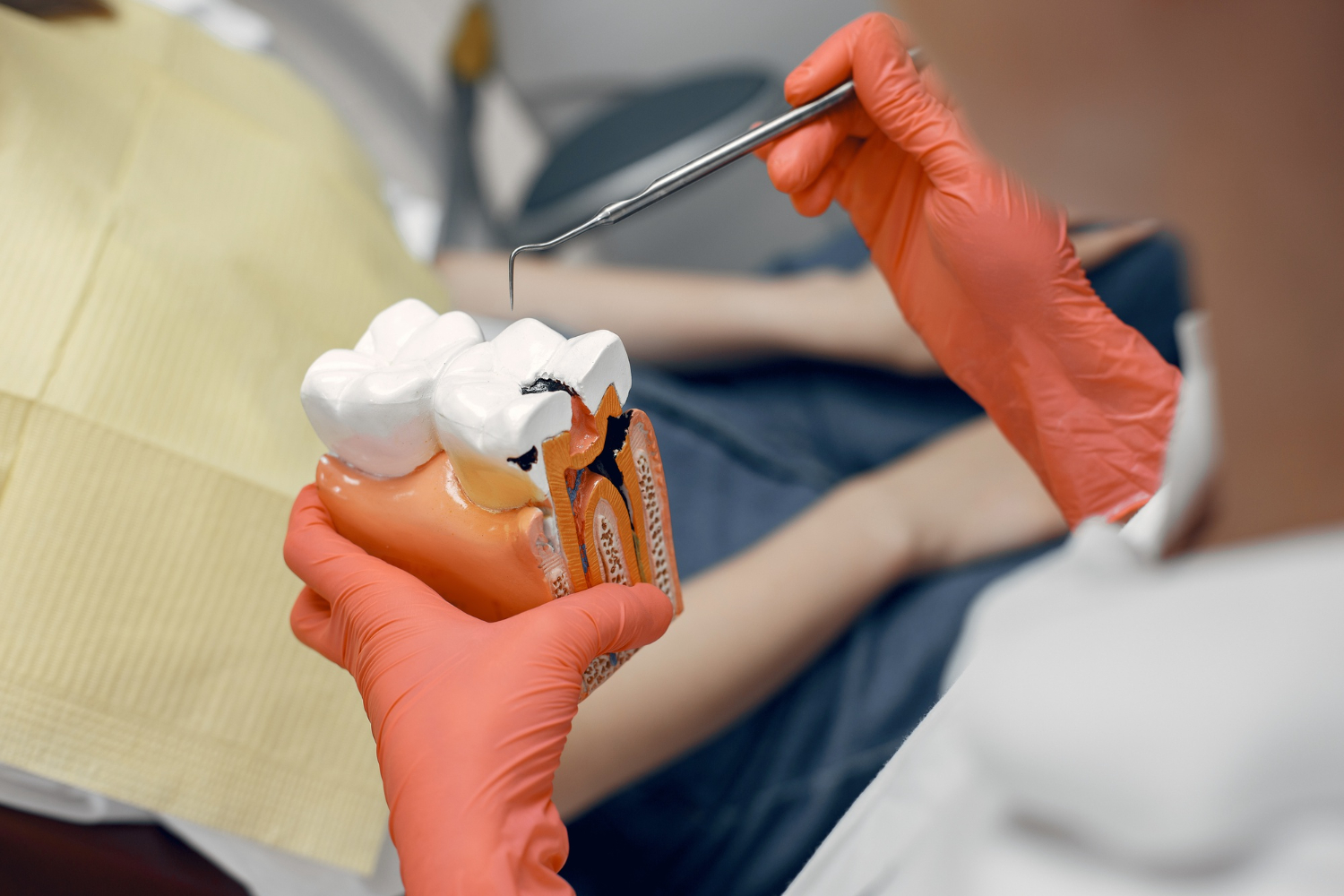 Wisdom Tooth