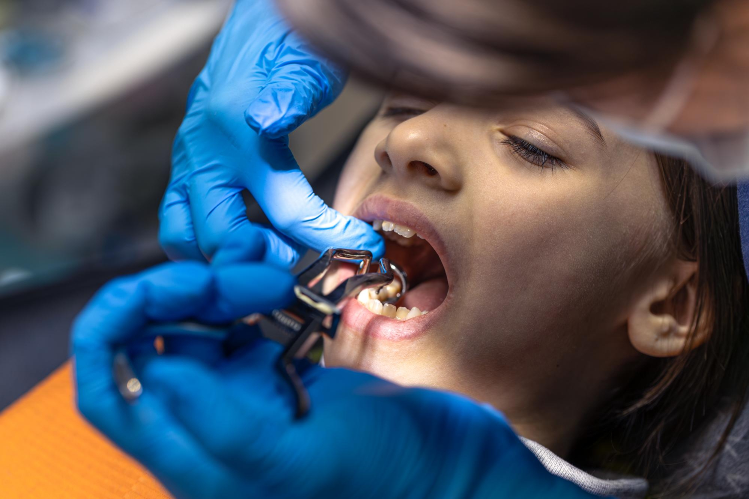 Wisdom Tooth